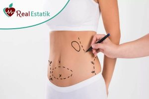 tummy tuck surgery in turkey